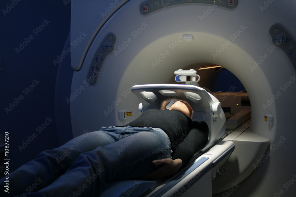 Votre tête en modèle STL 3D à partir d’une IRM Cérébrale